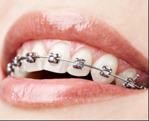 SMILE WAY DENTAL CARE MANJERI