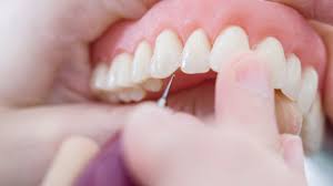 SMILE WAY DENTAL CARE MANJERI